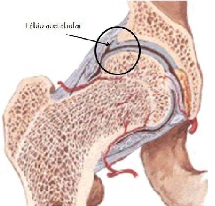 Impacto Femoroacetabular | Dr. Fernando Ferro | Cirurgia do Quadril em Goiânia