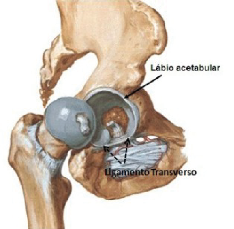 Impacto Femoroacetabular | Dr. Fernando Ferro | Cirurgia do Quadril em Goiânia